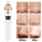 Electric Facial Skin Care Pore Cleanser Vacuum Acne Removal