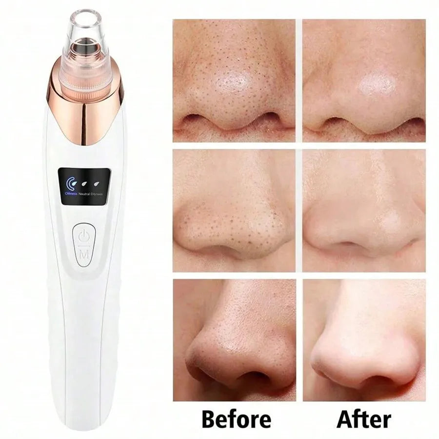 Electric Facial Skin Care Pore Cleanser Vacuum Acne Removal