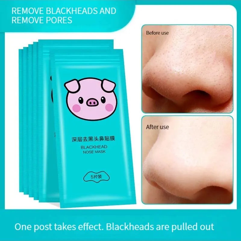 Blackhead Removal Nasal Strip Acne Magic Powerful Adsorption
